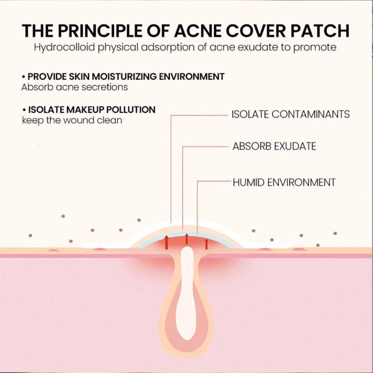200PCS water-based gel acne patch for reducing acne, used once for facial and skin night spot stickers acne patches